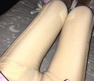 水动力吸脂瘦大腿让我告别小粗腿 快来看看果