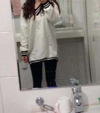 抽脂减肥瘦大腿价格10800元,一个月后恢复很好