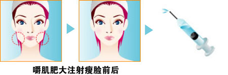 B****手术前后的对比图