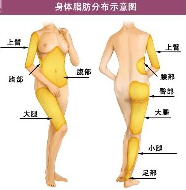 360°环形吸脂减肥简介