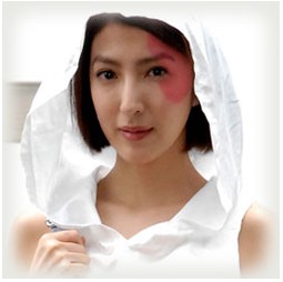 迎来自信的有方式——激光祛除胎记