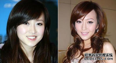 明星都爱注射美容