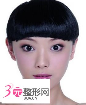 手术去眼袋