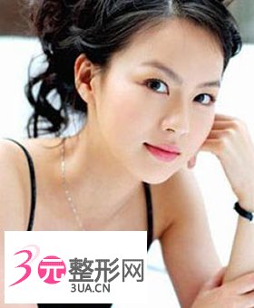 埋线双眼皮价格