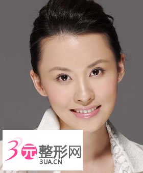 眼袋切除术果