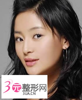 激光去斑有副作用吗