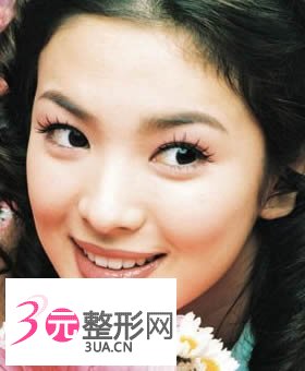 如何缓解红血丝