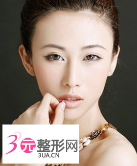双眼皮手术多久能恢复