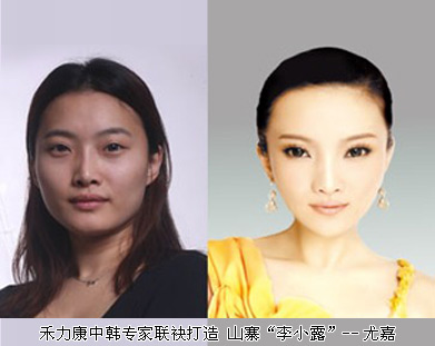 禾力康成功打造人造\李小璐\<em>尤嘉</em>