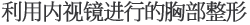 利用内视镜进行的胸部整形