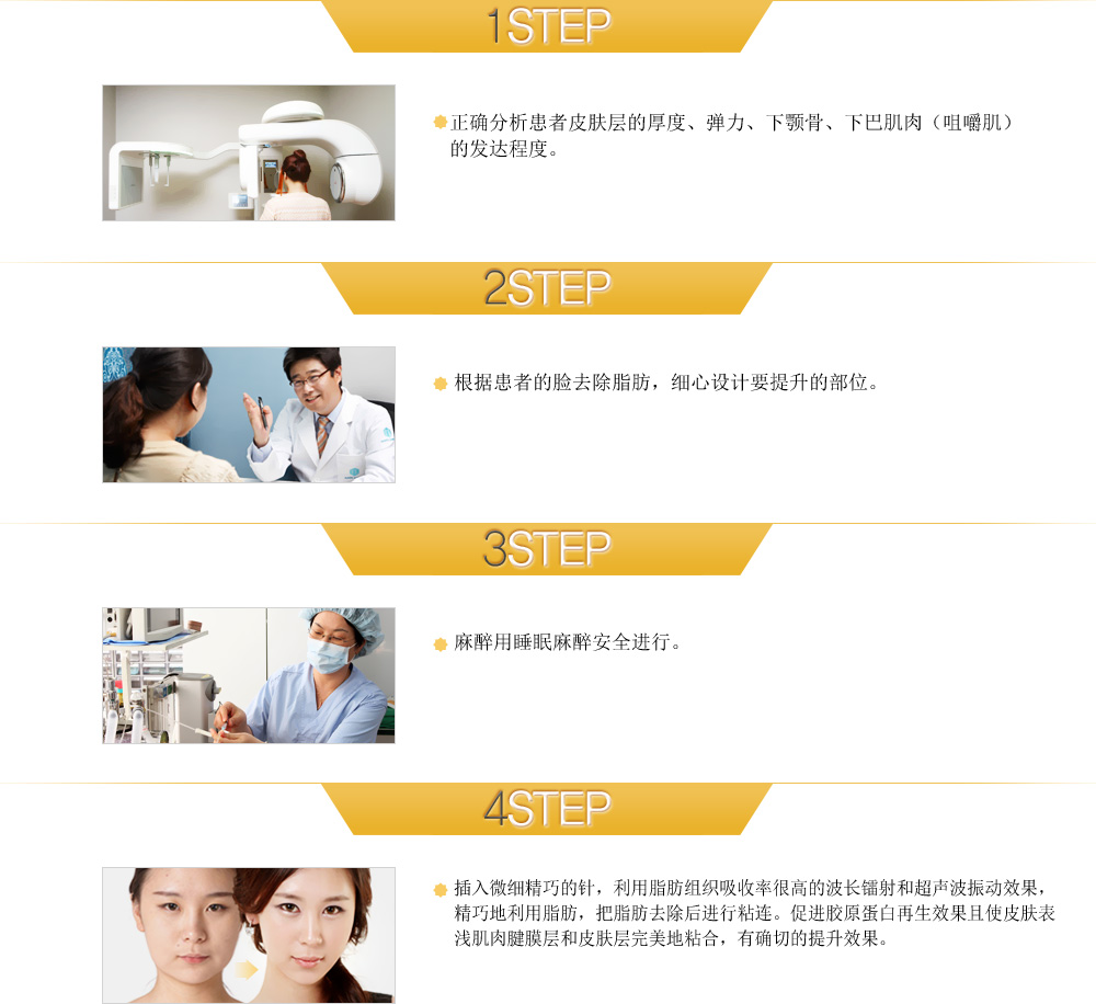 1STEP 正确分析患者皮肤层的厚度、弹力、下颚骨、下巴肌肉（咀嚼肌）的发达程度。
2STEP 根据患者的脸去除脂肪，细心设计要提升的部位。 
3STEP mz用睡眠mz降低风险进行。
4STEP 插入微细精巧的针，利用脂肪组织吸收率很高的波长镭射和超声波振动果，精巧地利用脂肪，把脂肪去除后进行粘连。促进胶原蛋白再生果且使皮肤表浅肌肉腱膜层和皮肤层**地粘合，有确切的提升果。