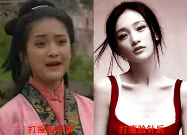 【B****前后对比图】揭秘娱乐圈女星打B****前后对比图