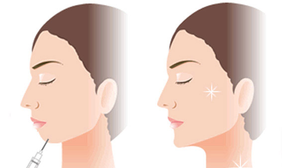 手术整形,微整形