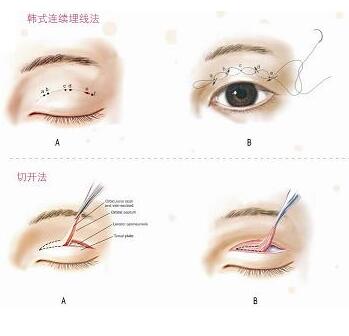 淮南华美整形医院价格表Z真实预览版