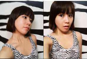 为大家分享我在北京301医院做下颌角整形的真实历程