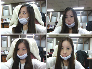 为大家分享我在北京301医院做下颌角整形的真实历程