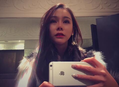 成都天使之翼做隆鼻整形改变了我的塌鼻子 果真的很不错