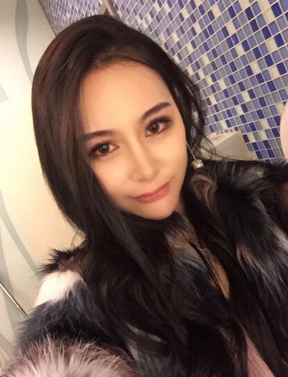 成都天使之翼做隆鼻整形改变了我的塌鼻子 果真的很不错