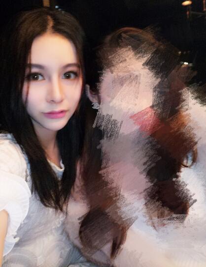 成都天使之翼做隆鼻整形改变了我的塌鼻子 果真的很不错