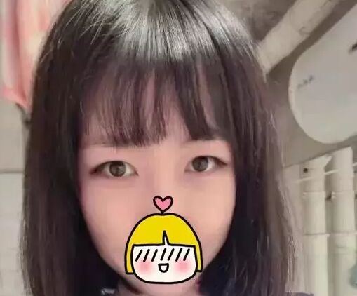 双眼皮修复需要慎重 可是我幸运的修复好了双眼皮