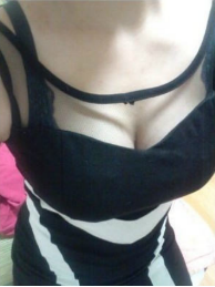 假体隆胸让我告别小平胸 感谢北京彤美