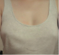 假体隆胸让我告别小平胸 感谢北京彤美