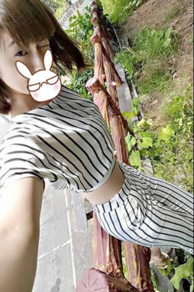 吸脂瘦大腿让我变回纤纤细腿