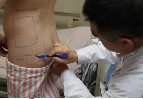 抽脂减肥瘦小腹 终于可以不用节食锻炼了