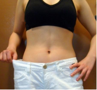 抽脂减肥瘦小腹 终于可以不用节食锻炼了