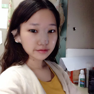 耳软骨隆鼻改变了我的塌鼻梁 北京彤美做的果很棒