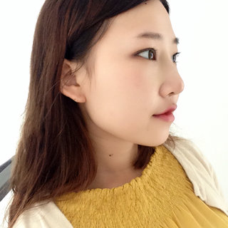 耳软骨隆鼻改变了我的塌鼻梁 北京彤美做的果很棒