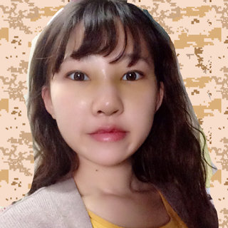 耳软骨隆鼻改变了我的塌鼻梁 北京彤美做的果很棒