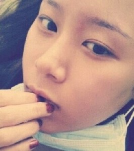 颧骨整形后我也变得甜美了