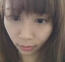 颧骨整形后我也变得甜美了