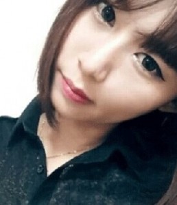 颧骨整形后我也变得甜美了