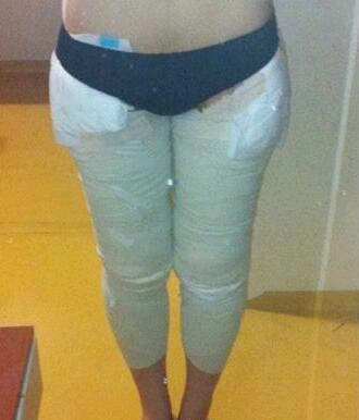 吸脂瘦大腿让我夏天放肆(｡･∀･)ﾉﾞ嗨