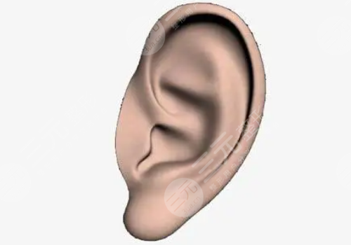 全耳再造手术适合哪些人?