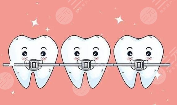 牙齿矫正过程分为几步?