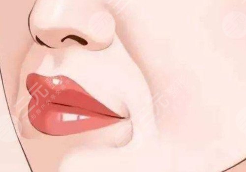 唇部注射玻尿酸需要注意什么？