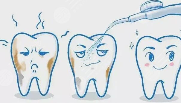 预防牙周病