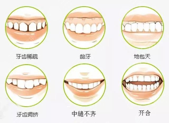 北京东方医院口腔科特色项目案例:牙齿矫正案例