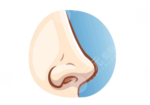 鼻子缩小整形手术