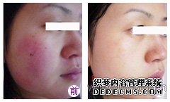 黑脸娃娃案例对比图