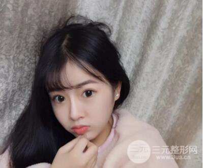 我的自体脂肪面部填充日记