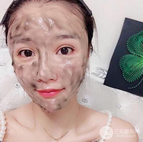 辣妈做了自体脂肪填充全脸，对比图分享