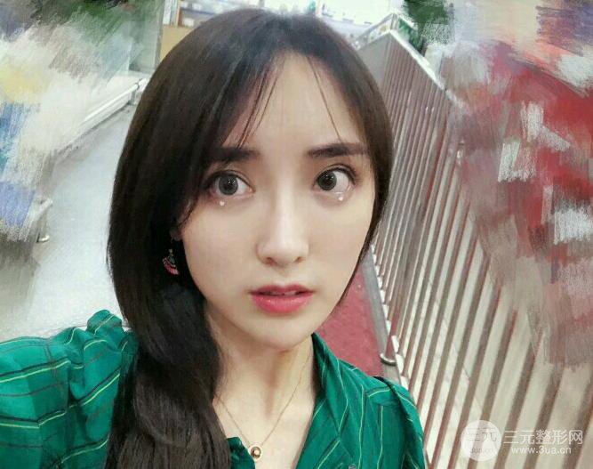 东莞宝格丽韦文奇隆鼻整形果图分享，对比曝光