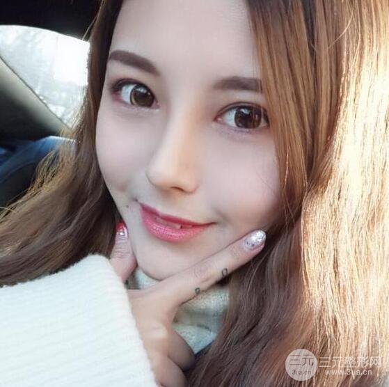 杭州恒颜医疗美容赵德星肋软骨隆鼻术后六十天全记录