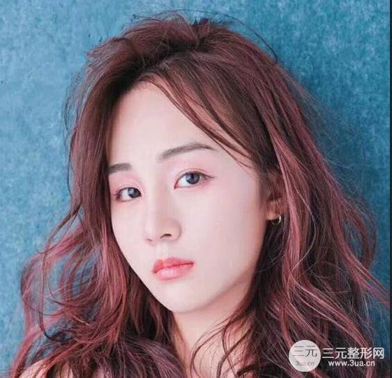 杭州恒颜医疗美容赵德星隆鼻整形手术恢复过程图