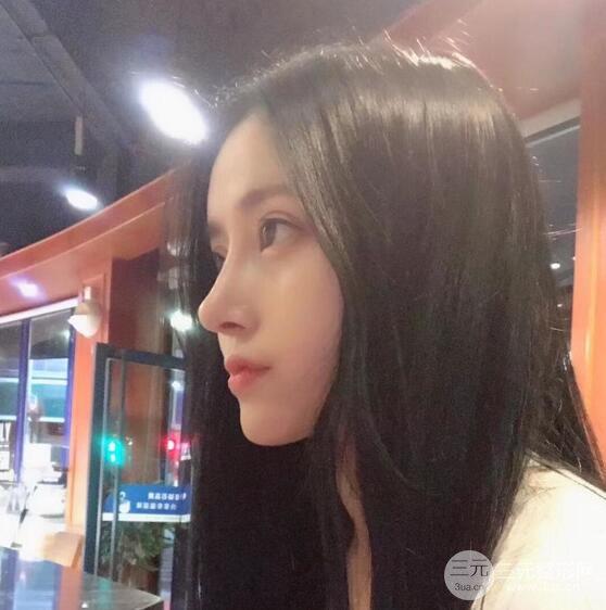 膨体隆鼻和双眼皮一起做的果怎么样？