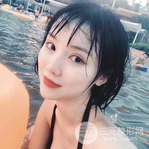 全切双眼皮半个月恢复全记录